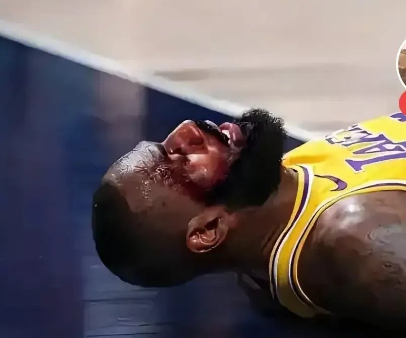 金州勇士队球员在比赛中受到侵犯 金州勇士队球员在比赛中受到侵犯